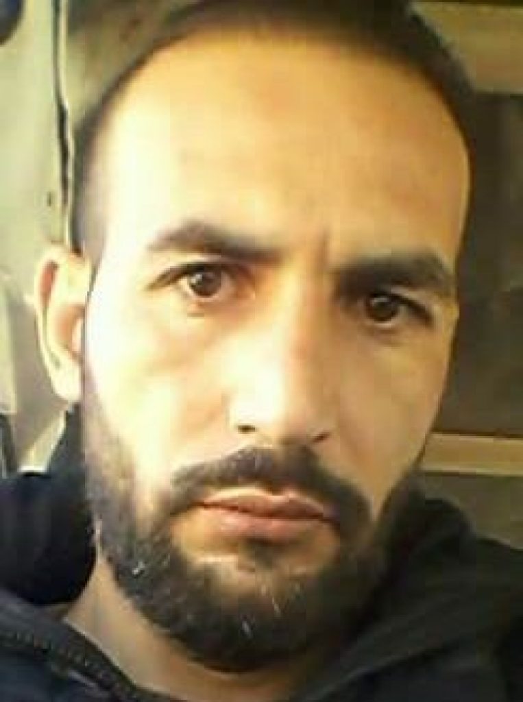 ولادة قيصرية